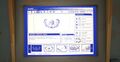 Thumbnail for version as of 03:35, 26 March 2025